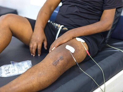 Rehabilitación tras accidentes viales: el costo oculto en República Dominicana