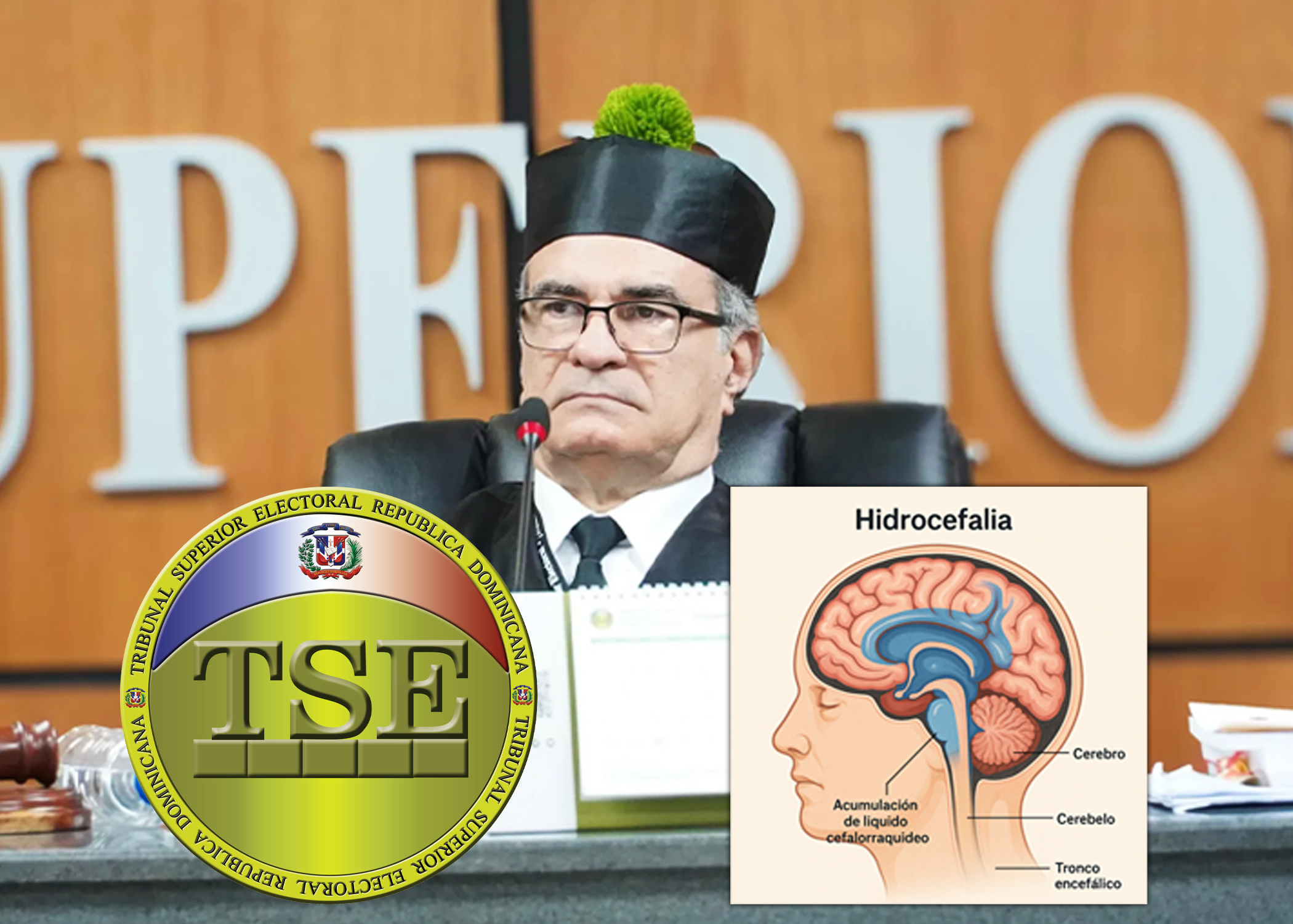 Ingresan en centro médico al presidente del TSE, será intervenido quirúrgicamente para tratar la hidrocefalia
